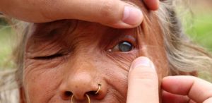 Médico cura cegueira