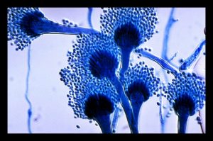 Aspergillus fumigatus