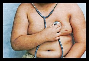 adoçantes artificiais