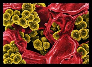 Staphylococcus aureus
