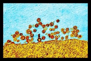 Infusão de anticorpos