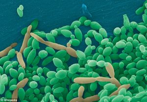 causa da doença de crohn