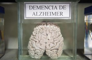 biblioteca de cérebros