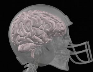 concussão causa Alzheimer