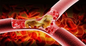 concentração de colesterol bom