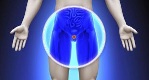 câncer de próstata agressivo