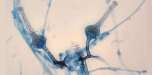 Saksenaea vasiformis