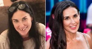 perder dentes por estresse