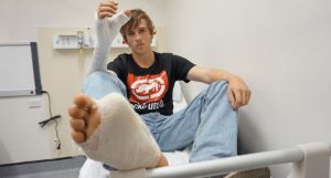 dedão do pé transplantado