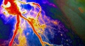 risco de ataques cardíacos