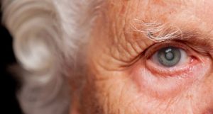 cirurgia de catarata