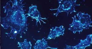 tumor cerebral incurável