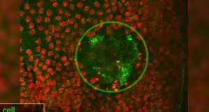 cicatrização de feridas