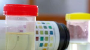 câncer de ovário