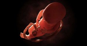 transplante de útero