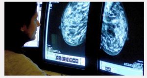 terapia de reposição hormonal