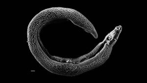 Schistosoma haematobium