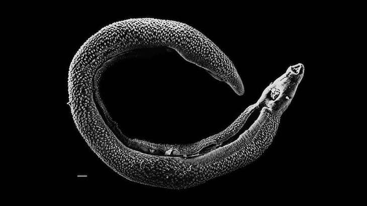 Schistosoma haematobium