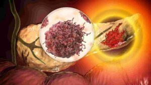 exame pancreas