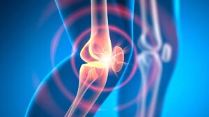 osteoartrite