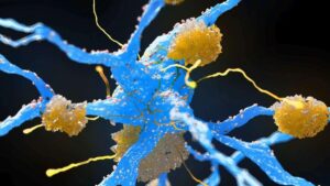 GLP-1 Alzheimer