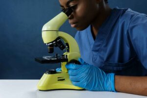 Amostra de tecido inflamado do intestino observada em microscópio de laboratório