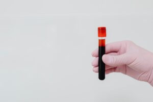 Amostra de sangue em tubo de ensaio dentro de laboratório de análises clínicas