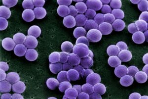 Imagem de Staphylococcus aureus vista ao microscópio, bactéria alvo do estudo em salas de velório
